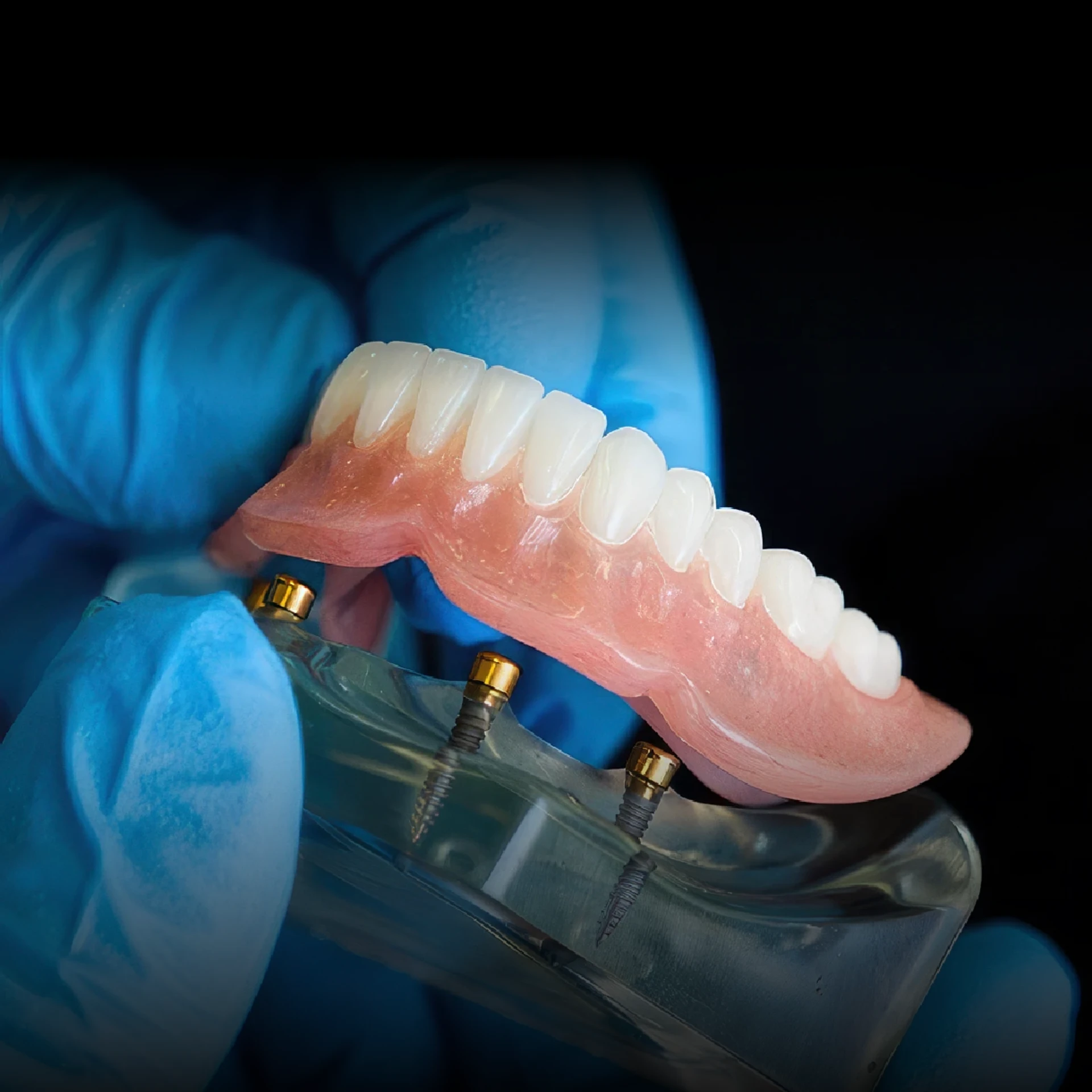 Photo of dentist holding a 4-implant lower Snap-In Implant Dentures