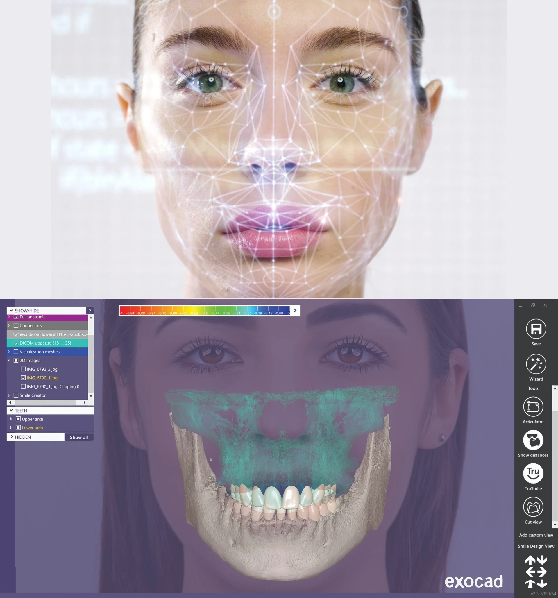 Facial scanner at Nashville Wisdom Teeth & Implant Solutions