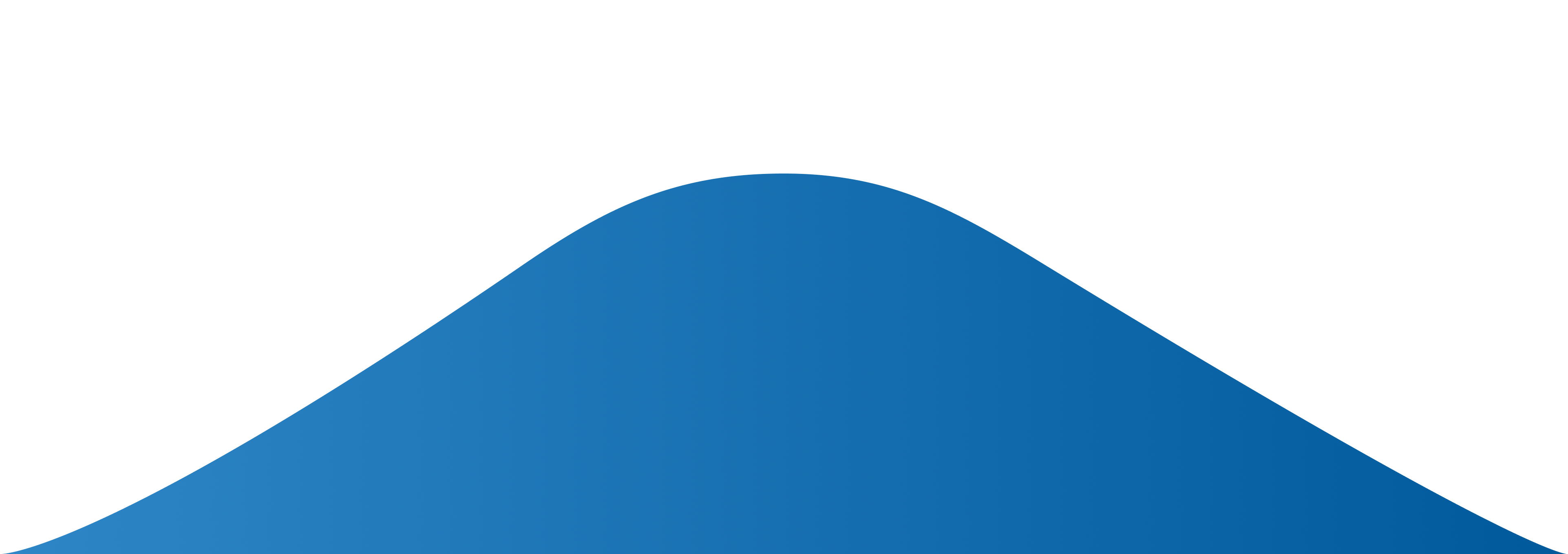 Bell curve showing the all-on-4 dental implants cost in Nashville, TN