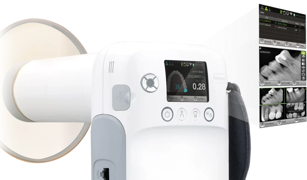 Portable x-ray technology at Nashville Wisdom Teeth & Implant Solutions