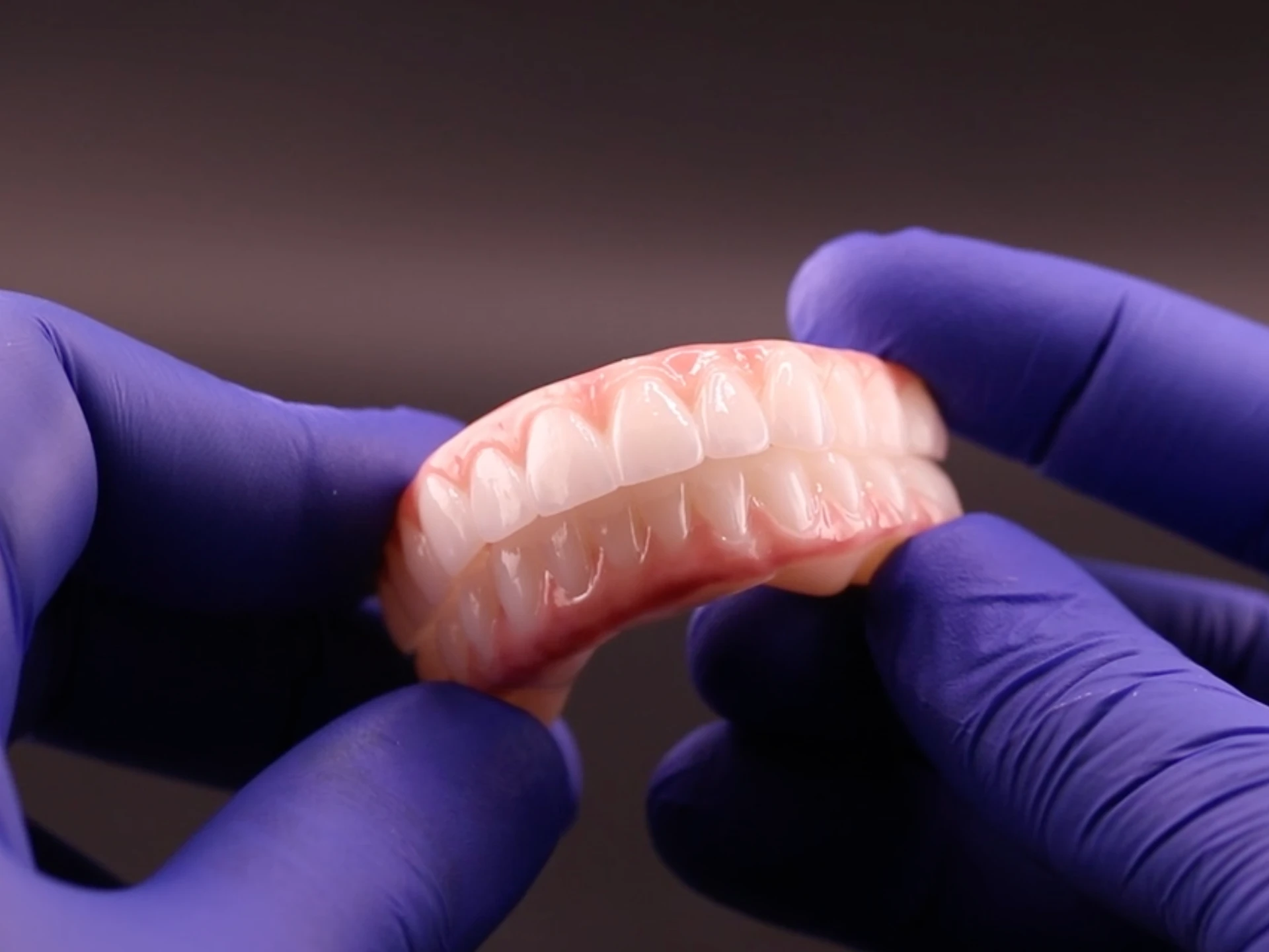 All-On-4 Dental Implants teeth being held by dentist